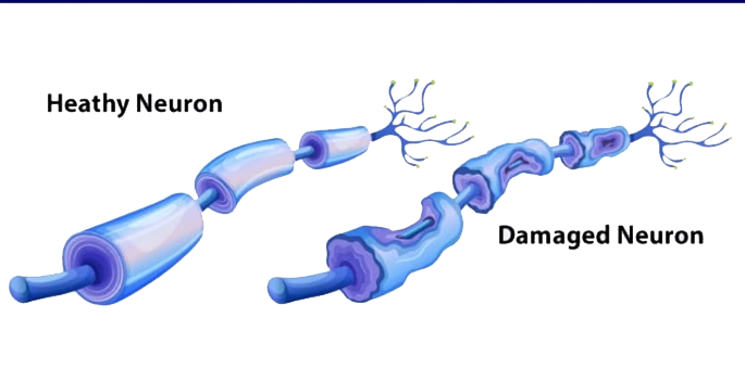 Damaged-and-Healthy-Neurons